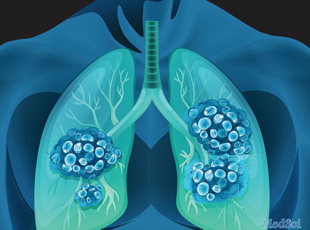 NHS支持Zykadia作为一线肺癌药物
