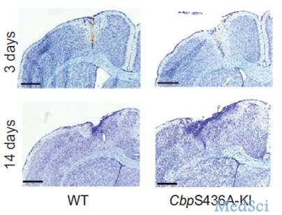 Stem Cell Rep：aPKC-CBP信号通路参与调节中风后神经血管的重塑和功能恢复！