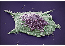 Nat Commun：最新研究成功切断癌细胞的“供给站”，癌细胞可以被饿死啦！