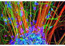 J Lasers Med Sci：低强度<font color="red">半导体</font>激光光动力疗法治疗种植体周围炎的效果