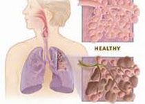 Eur Respir J：COPD患者肺<font color="red">气肿</font>和肺外组织损失！