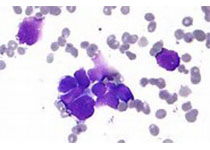 Med Oncol：Hippo信号通路和Aurora激酶基因在慢性<font color="red">粒细胞</font>白血病中的表达