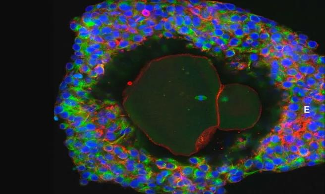Mol Hum Reprod:完<font color="red">全体</font>外培育的卵细胞，能否解决不孕难题？