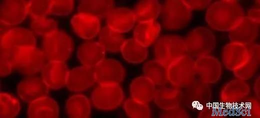 <font color="red">Nephrol</font> Dial Transpl：血液透析患者铁剂量如何影响住院和死亡率？