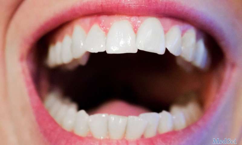 Medicine：荟萃分析显示牙周炎患者唾液<font color="red">MMP-8</font>的水平明显高于健康对照者