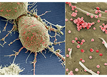 Sci Transl Med：<font color="red">哈医大</font>发明分子探针 可预测癌症靶向治疗效果