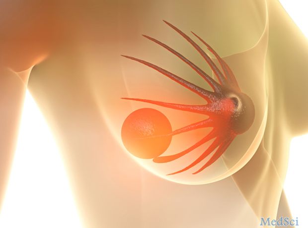 研究人员发现三阴性乳腺癌的“新靶点”