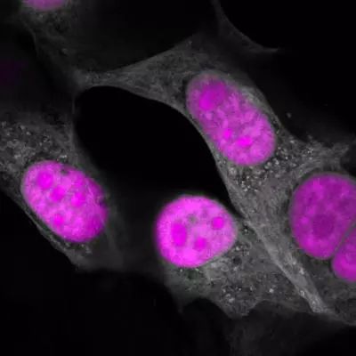 Cell：张锋学生带来CRISPR新工具，可靶向RNA进行编辑
