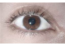 Curr Eye Res：<font color="red">视网膜</font>脱离和增殖性玻璃体<font color="red">视网膜</font>病变中抗<font color="red">视网膜</font>抗体的水平
