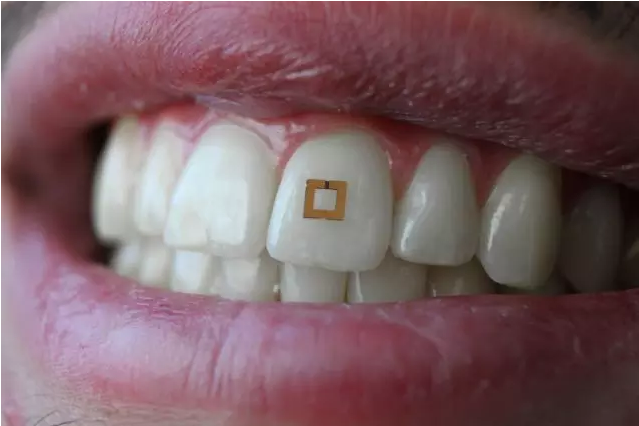 Advanced Materials：安装在牙齿上的传感器，帮助你追踪都吃了什么