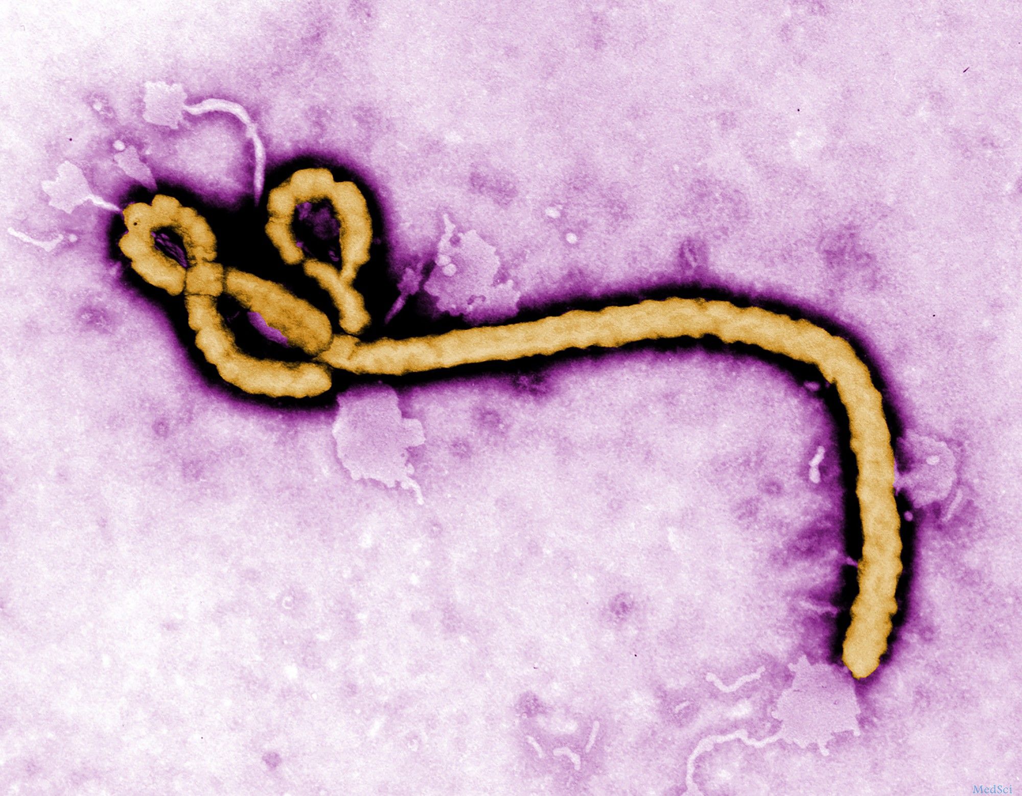 埃博拉病毒的新<font color="red">克星</font>：高剂量的法匹拉韦