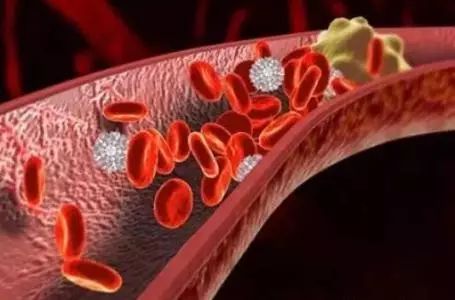 J Periodontol：牙周膜间充<font color="red">质</font>干细胞<font color="red">自</font><font color="red">噬</font>的激活促进牙周炎的血管生成