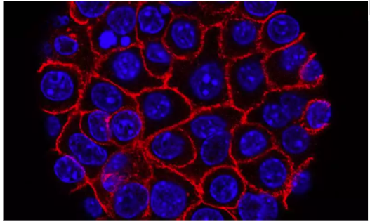 Cell & Science：癌细胞如何<font color="red">抵抗</font>化疗? 这两篇结构研究或许可以解释