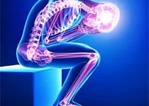 Med Sci Sports Exerc：客观测量的体力活动与膝关节骨性关节炎的发生风险