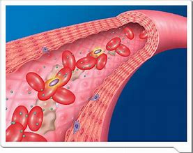 【盘点】急性淋巴细胞<font color="red">白血病</font>近期重要研究进展汇总