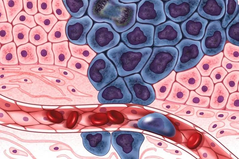Cell：超大型基因图谱研究将癌症重新“归类”