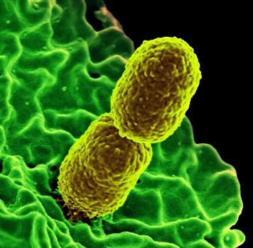 Microb Biotechnol：生物膜内菌群之间的相互作用