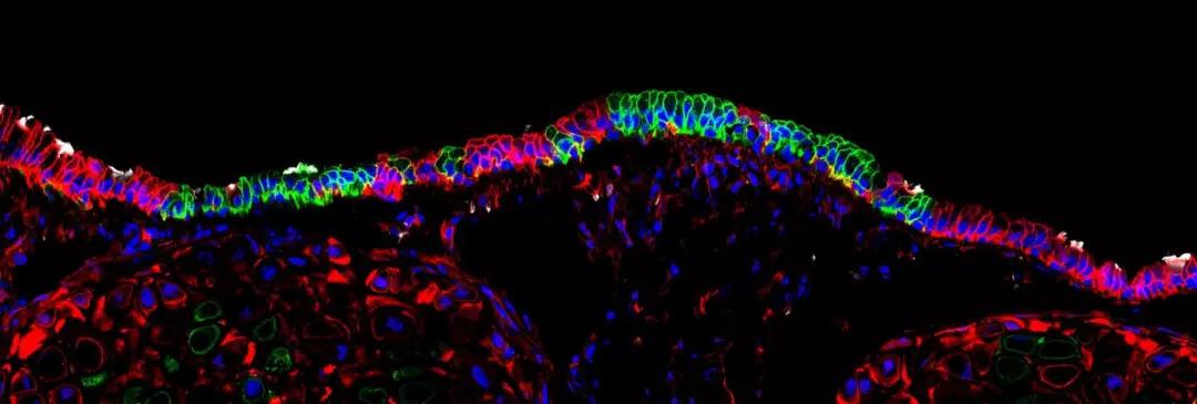 Cell Stem Cell：干细胞修复<font color="red">呼吸</font>道损伤重要靶点