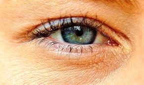Retina：弹性假黄褐斑患者的视觉特征