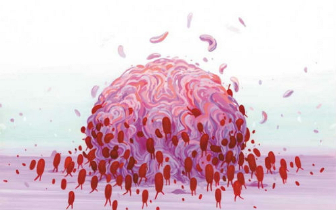 JAMA Oncol：脑洞大开：CT扫描肌肉和脂肪可预测非转移性乳腺癌患者<font color="red">生存</font>