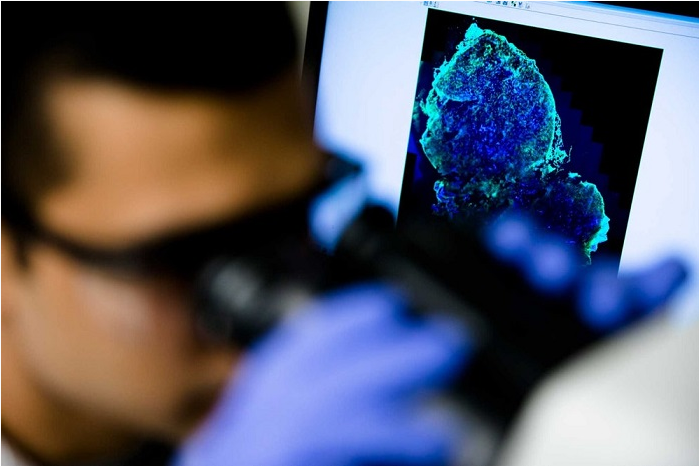 Mol Pharmaceutics：科学家研制荧光造影新药 为乳腺癌诊断提供新工具