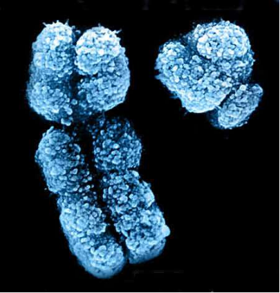 Nat Genet：首个！科学家在 Y 染色体上找到白血病抑制基因