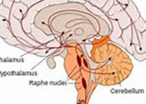 JAMA Neurol：脑脊液tau蛋白病变的性别差异