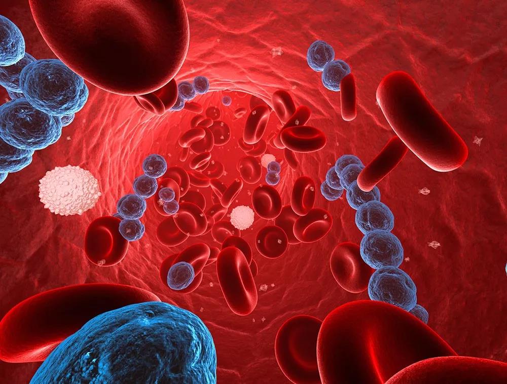 Gastroenterology：香港中文大学科学家发现，血液中有这几种<font color="red">菌</font>，患结直肠癌风险最高可增加16倍