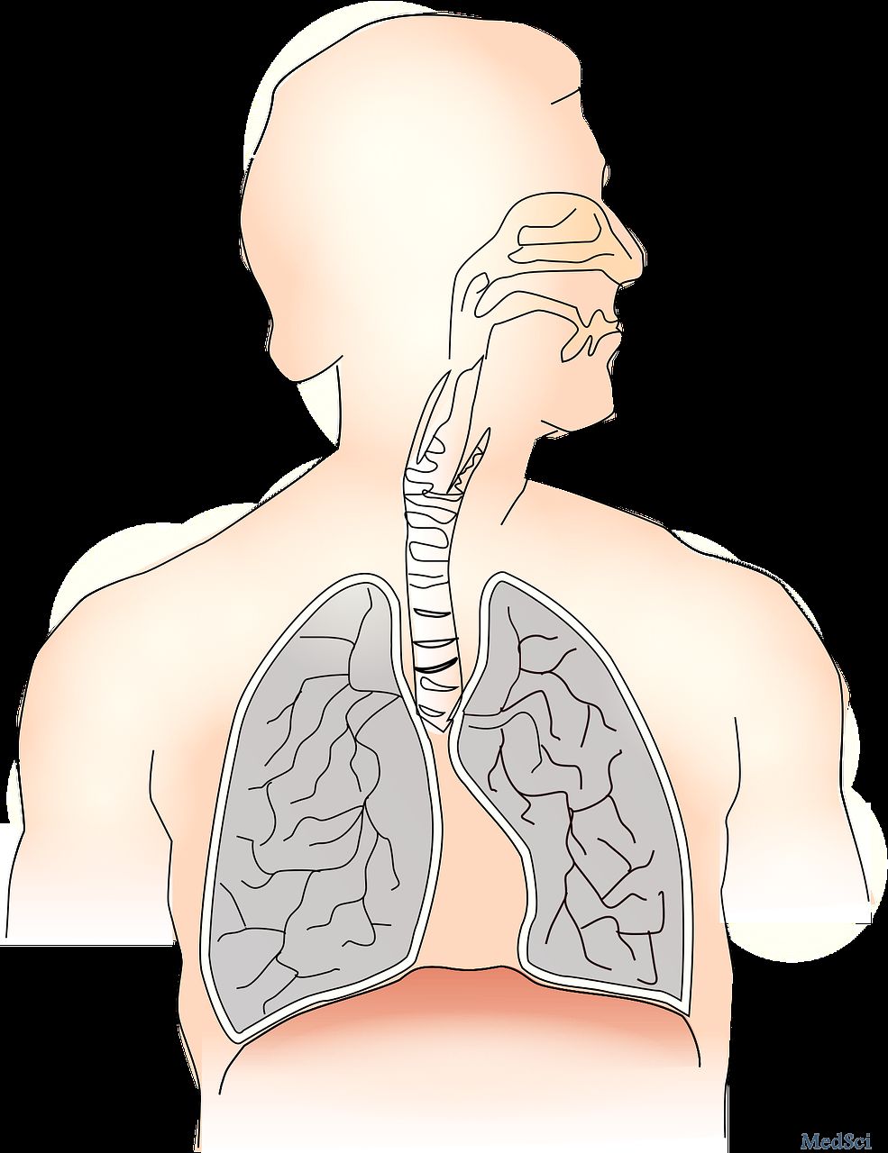 PLOS ONE：鼻内递送VEGF帮助代偿性肺生长