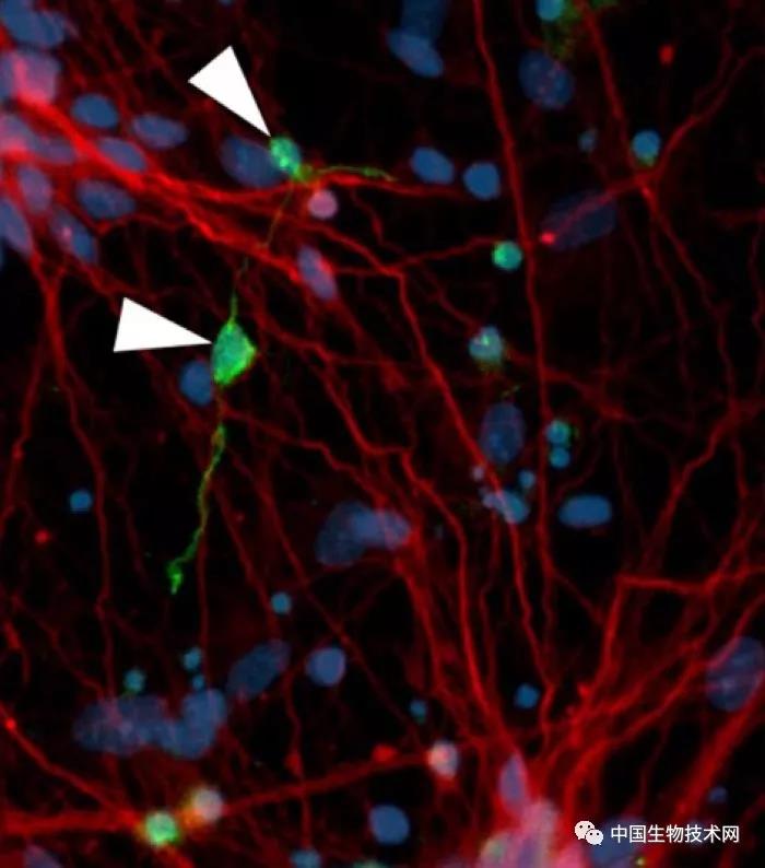 Stem cell rep：到底是什么杀死阿尔兹海默<font color="red">症</font>患者的脑细胞？