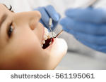 J Periodontal Res：转录因子DEC1促进牙周炎的发生