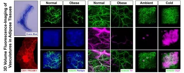 Molecular Metabolism：脂肪组织内血管的全组织三维分布及交感神经调控血管可塑性的重要功能