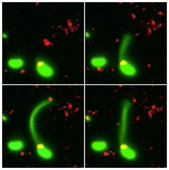 Nat Micro：科学家首次拍到<font color="red">细菌</font>用长长秀发“抢”DNA的瞬间