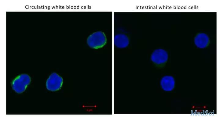 Sci Immunol：肠道免疫<font color="red">细胞</font>有个“低电量模式”