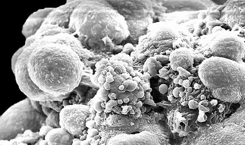 让休眠细胞继续睡 科学家尝试了解蛰伏的癌细胞