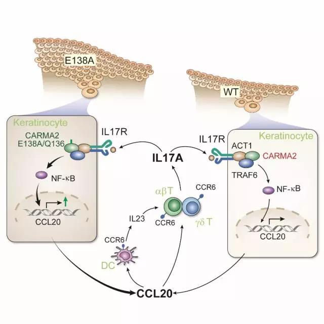 Immunity：Card14基因突变促进皮肤<font color="red">角质</font><font color="red">细胞</font>对IL-17A的应答诱导银屑病发生的分子机制
