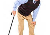 J Rheumatol：老年强直性脊柱炎患者膝关节和髋关节置换术发生率升高