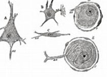 Neurology：小头畸形患者视网膜和视神经的形态特征研究