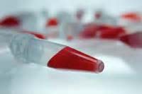 新的<font color="red">抗凝血</font>药物可降低严重出血风险