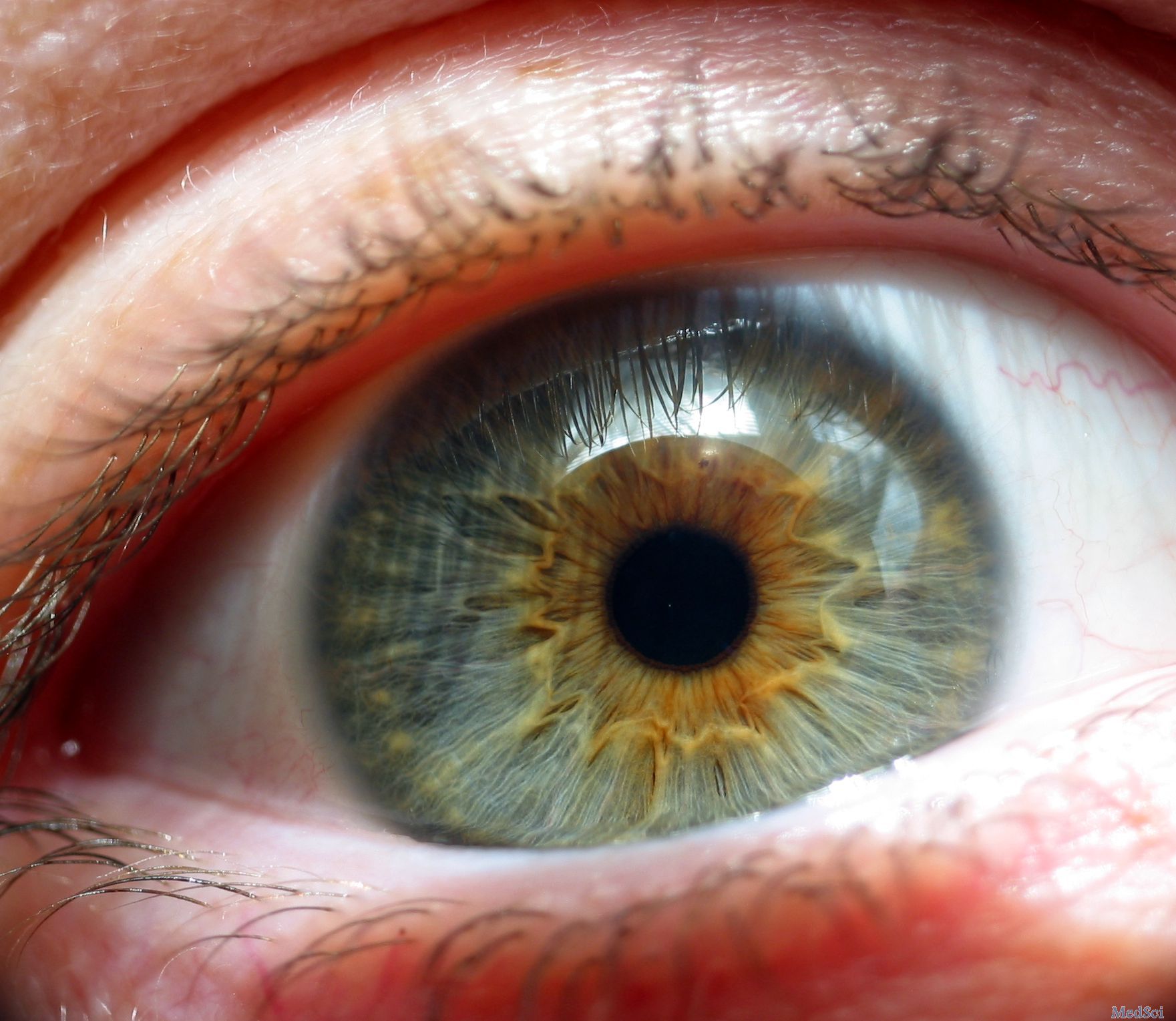 Cont Lens Anterior Eye：在佩戴<font color="red">小型</font>巩膜隐形眼镜后前眼表面发生变化