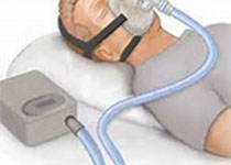 Am J Resp Crit Care：吸氧对阻塞性睡眠呼吸暂停患者血压的影响