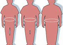 Biol Sex Differ：不同的胖男胖女面临不同的心血管代谢风险