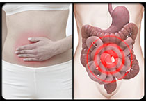 GUT：谷氨酰胺治疗感染后腹泻型肠易激综合征