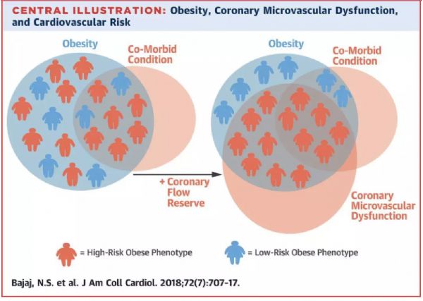 JACC：CMD作为肥胖患者的心血管风险<font color="red">指标</font>更简便