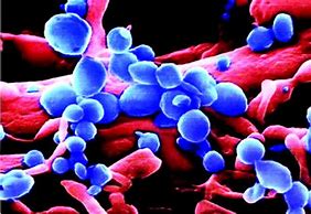 Science Bulletin：全球首例人感染H7N4<font color="red">禽流感病毒</font>病例