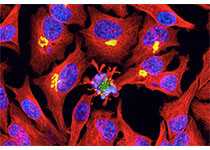 Cell Res：薛愿超组揭示<font color="red">胞</font>苷脱氨酶AID特异性识别靶位点的新机制