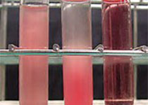 Blood：Charcot-Leyden晶体形成与胞外诱捕<font color="red">细胞</font>死亡密切相关