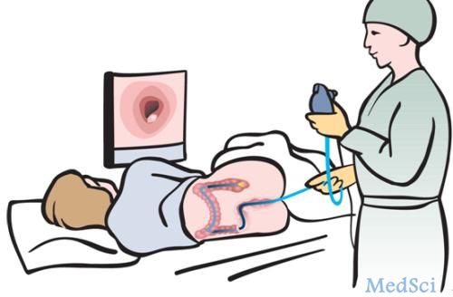 J Clin Gastro： 早期使用结肠镜检查不会增加下消化道出血的危险性