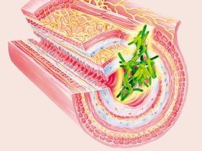 J Gastroenterology： 克罗恩病患者中肠源干细胞的<font color="red">修饰</font>与疾病活动存在相互影响