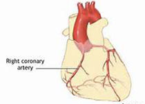 Int <font color="red">J</font> Cardiol：舒张压<font color="red">J</font>型曲线的机制：亚临床心肌损伤和免疫激活